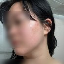 관리 받아보면 더 받고 싶은 봉선동피부관리실 이엘에스테틱 솔직 후기~!