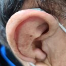 바른보청기히어링케어 이미지