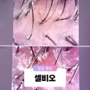 강남구청 | 청담 헤드스파 70분 풀코스 두피클리닉 케어 셀비오 강남구청점 솔직 후기