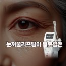 대구 눈꺼풀처짐 눈처짐엔 버츄rf 왜 좋을까요? 동대구에스미의원 박나연 원장