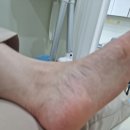 팀네일&레푸스아산
