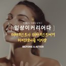 브리앙슈 이지다 | [임상이커리어다] 이지다스파 피부 전문가에게 이지샷으로 보여준 효과