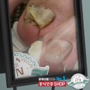 주주네일 이미지