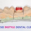 앞선치과기공소 이미지