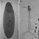 2생목 흡충 Clinostomum complanatum 이미지