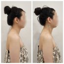 구리 신부관리 오늘 동안에서 윤곽관리 어깨 등 팔라인, 피부 관리