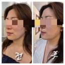 뷰티몬스터 이미지