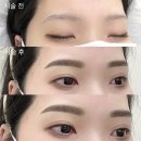 리메이드 이미지