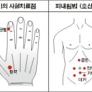 감기의 광명의학 이미지