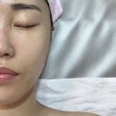 중동뷰티호텔 | 부천중동에스테틱 뷰티호텔180 모공디톡스 재생케어 후기