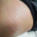 스칼프디자인센터 이미지