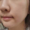 휴먼테크 | &#39;리어퍼스트로피&#39; 엑소좀앰플, 스킨부스터앰플 사용후기