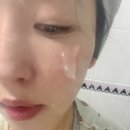 뽀드독 | 여드름 속 건조 홍조 정착템, 제로이드 클렌징젤 내돈내산 솔직후기