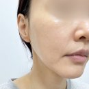 (주)오에이에이지 코리아 | 기미팩 셀폰즈 레가토닝 바쿠치올 조합 써본 솔직 후기