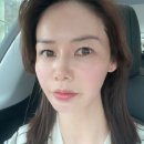 써니 | 강남피부과 청담피부과 써니레이저 후기 리프팅 효과 느낀 변화