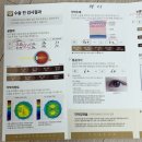 [라식라섹후기] 강남ㅂㄹㄷ안과 투데이라섹 찐 후기