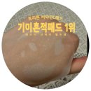 흔적으로의 여행 | 얇고 착! 붙는 토리든 비타민씨 패드 | 여름 여행 흔적 케어 찐후기요