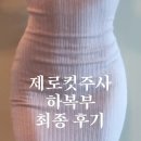 제이제이쇼핑몰 | 강남 지방분해주사 제로컷 하복부 5회차 최종후기
