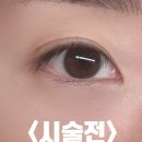 [구월동속눈썹펌 뷰미 / 인형같은 눈매로 보이는 노글루 속눈썹펌 후기]