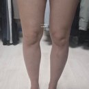 연세두루의원 | 이천 다이어트 카복시시술 내돈내산후기 같이 다이어트해요, 연세두루의원