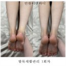 초지역 1번출구 앞 | 안산 에스테틱 안산 피부관리.