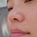 브이에스텍(주) | 평택 리프팅 맛집 뜰에스테틱) 소사벌 피부관리 신부관리 추천