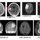 뇌 MRI, MRA 차이 & 머리 CT 촬영, 검사 방법 및 가격. 이미지