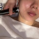 셀럽메디스파 우장산 | [목동피부관리] 물광피부 재생관리 잘하는 곳 "셀럽메디스파" 1:1 맞춤관리 후기