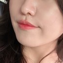 블라비의원 구월점 | 웨딩관리, 프라임레이즈, 벨라스트 팔자필러 2cc, 미간보톡스, 팔뚝 주사 후기
