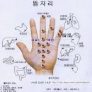 뜸 이미지