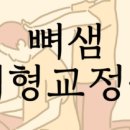 체형&채형 이미지