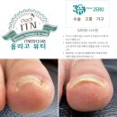 올리고뷰티