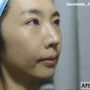 수려한비책자단메탈쿠션파운데이션]주름개선+미백+자외선차단 이것만있음 끝~! 올여름 원킬쿠션...