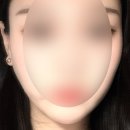 UR(구리시)-[갈매순환로]-상-4 | [구리] 마이크로젯 천방케어 바이오폭스 내돈내산 후기 피부관리는 더스무스 갈매점