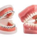 새로치과기공소 이미지