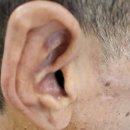 서울탑보청기 이미지