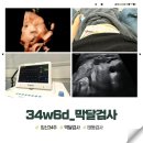 라움산부인과의원 | [34w6d] 34주임산부 막달검사 태동검사 평택라움산부인과 34주아기몸무게 초음파