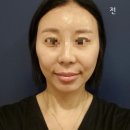 뷰티앤 | 구로 웨딩케어 에이치앤뷰티 후기｜N2spa 관리로 두피부터 윤곽까지 작은얼굴 라인 잡은 스페셜 케어