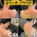 아세로짐 이미지