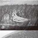 방어 근육 내의 선충류 이미지