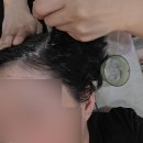 대구두피클리닉 더블유엠에스테틱 침산점 탈모관리 후기