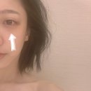 삼일한방사우나 | 홍대피부과 울트라콜200, 다크써클 눈가주름 개선 (주기/후기/효과)
