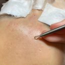 원 에스테틱 이미지