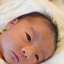 사랑의소아청소년과의원 | 아기 신생아 설소대 시술 후기 (연세사랑소아청소년과, 다산 진소아과)