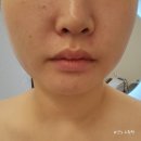 [연&#39;s 뽈뽈] 부산 웨딩케어 서면 피부관리 &#39;서면에스테틱라운지&#39;