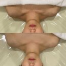 제니프 | 용산 피부관리 한번만으로도 효과대박 제니프 에스테틱 방문 후기