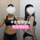 수지척추체형교정