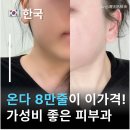 꽉언니쌀롱 | 인천 온다 리프팅 8만줄 1회 후기, 피부과 통증·효과 솔직 정리