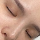 신천소공원로R | 울산속눈썹펌추천 모어뷰티 클리닉영양펌