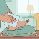 통풍 발작 시 응급처치, 냉찜질 vs 온찜질 정답은 이미지